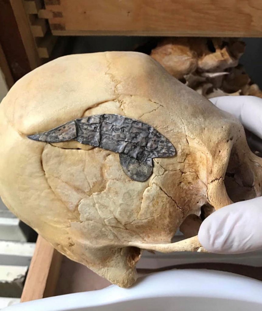 Ancient Peruvian skull | From the blog of Nicholas C. Rossis, author of science fiction, the Pearseus epic fantasy series and children's books